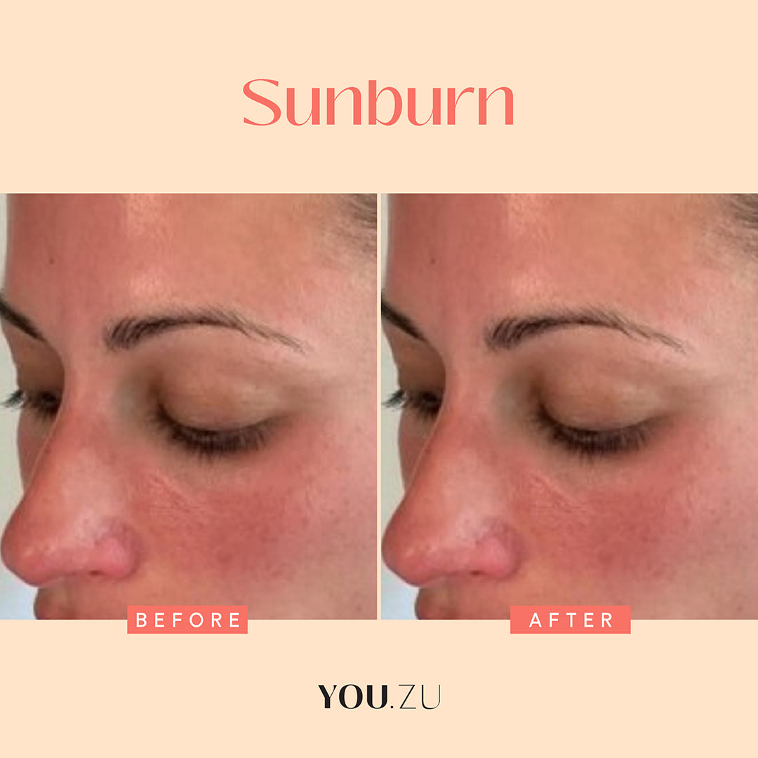Youzu, Daily Refresh Serum