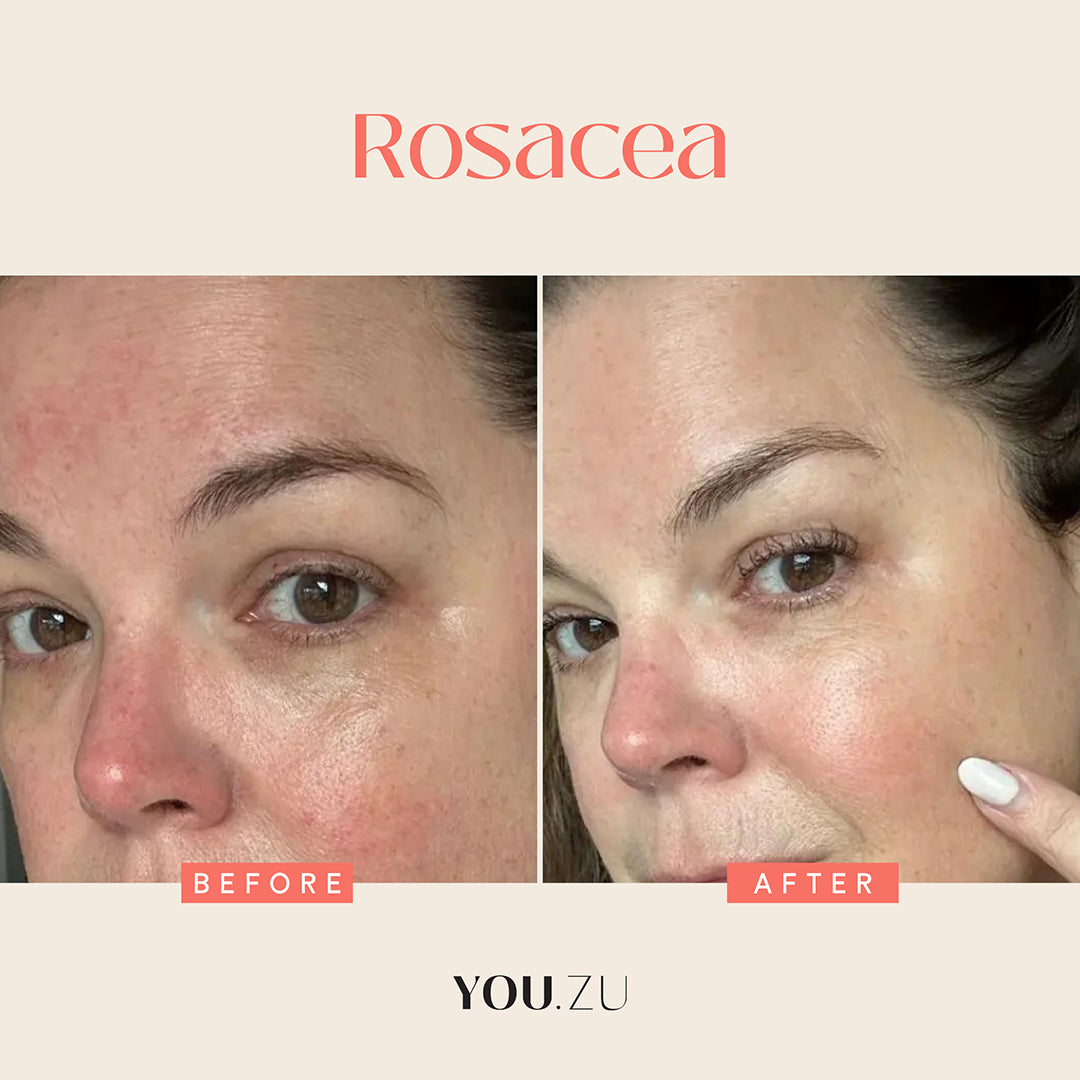 Youzu, Daily Refresh Serum